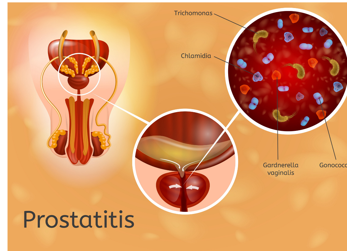 premature-ejaculation-treatment-in-noida