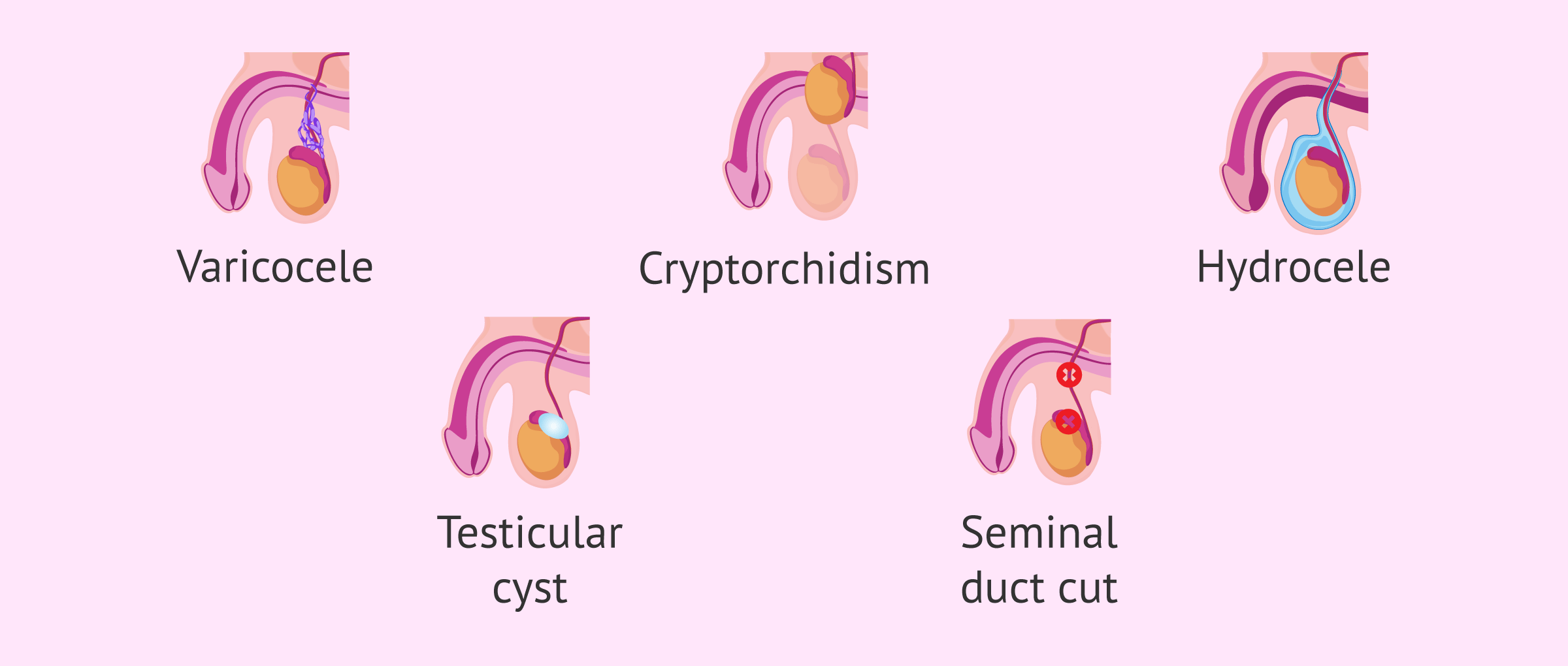 premature-ejaculation-treatment-in-noida